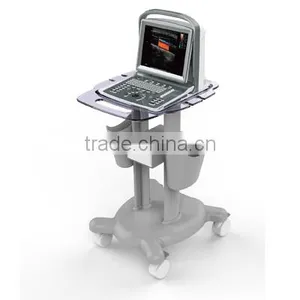 Portable Ultrasound Scanner Color Doppler Ultrasound System thumbnail-2