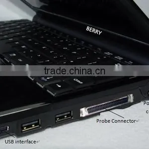 Convenient With Screen 10.1 LED Portable Ultrasound Machine Price Cheaper Supplier's Choice thumbnail-1
