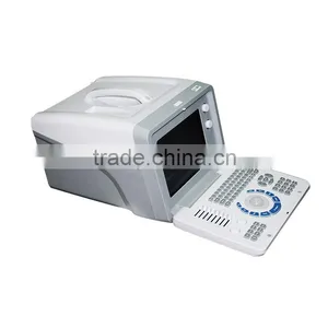 New Ultrasound Machine / Scanner Portable Ultrasonic Diagnostic System RUS-6000D With 3.5MHz Convex Probe Manufacturer thumbnail-4