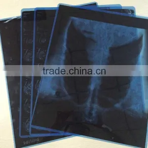 Medical X-ray Film Agfa Medical Dry Film for X-ray Machine Agfa Kodak Film thumbnail-1