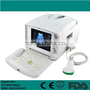 CE ISO Certified Portable Ultrasound Scanner Machine With Cheap Price thumbnail-1