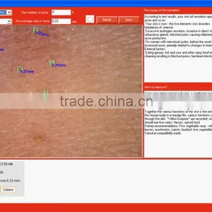 Professional Clinic Use Face Skin Analysis Equipment With FCC/CE Approval thumbnail-3