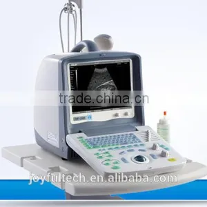 Obstetric Ultrasound System Ultrasound Scan Machine thumbnail-1