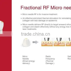 Best Fractional Rf Microneedle Face Lifting Thermagic Rf Equipment thumbnail-3