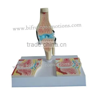 Knee Skeleton Model, Medical Teaching Model thumbnail-1