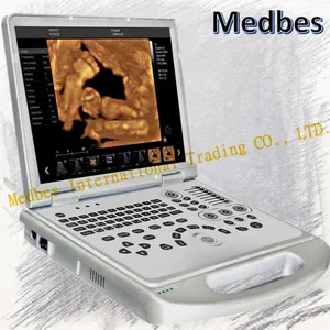 Ce Approved Medical Portable 3D Color Doppler Ultrasound System thumbnail-1
