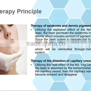 Beauty Best Medical Use Q-switched nd Yag Laser for Tattoo Removal/medical Laser nd Yag/yag Laser Tattoo Removal thumbnail-6