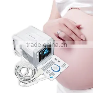 2016 Medical Equipment Hospital CE Approved Digital Style Ultrasound Machine/Scanner For Sale With Cheap Price thumbnail-6
