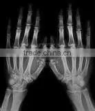 Wholesale X-ray Medical Film, Digital Radiography Film,digital Dry Film Made in China thumbnail-1