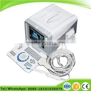 Portable Ultrasound Scanner Diagnostic Machine With 3.5MHz Convex Probe thumbnail-1