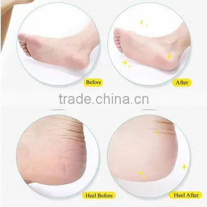 Battery Operated Manicure Kits/foot Skin Removal Tool Buy 1 Device 4 Pcs for Free thumbnail-4