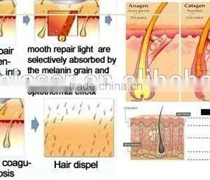 High Intensity RF Machine for Skin Tightening Face Lifting thumbnail-4