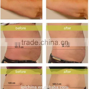 2015 New Hot PEMF & RF Body Sliming Salon Machine - CE thumbnail-6