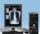 RX2210 High Frequency Digital X-ray Radiography System thumbnail-2