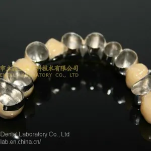 Dental Crown Composite, Dental Teeth, Dental Prosthesis, Laboratoire Dentaire, Dentallabor, Laboratorio Dental, Dental Laboratory, Shenzhen LJ Dental Lab China thumbnail-5