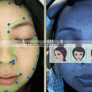 Auto Facial Skin Portable Analyzer With Customer Datebase and 10 Mega Pixels Camera thumbnail-5