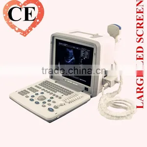 2016 Large Screen LED Clear Image Full Digital Portable Ultrasounic Scanner Machine System With 2 Probe Connector thumbnail-1
