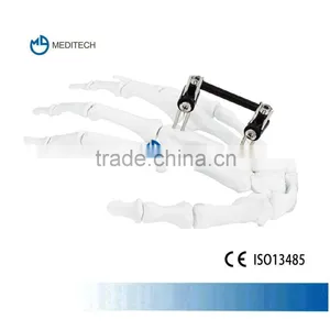 Orthofix Mini External Fixation Orthopedic Surgical Instruments Type E thumbnail-1
