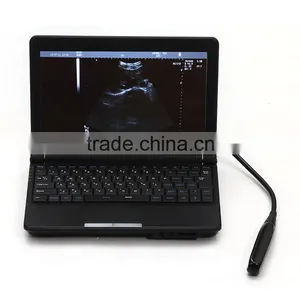 Cheap Portable Ultrasound ce Approved Veterinary Use Full Digital Ultrasound Scanner thumbnail-2