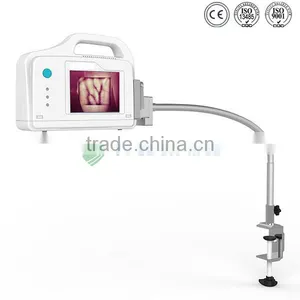 YSVV200 Guanghzou Hot Vein Illumination Device Price thumbnail-2