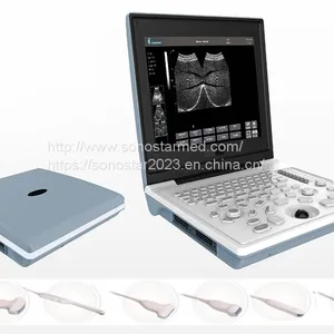 SS-6B Laptop All-Digital Ultrasound thumbnail-3