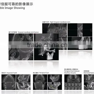 Digital 3D Intra-oral Imaging X-ray Machine thumbnail-6