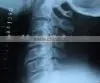 Imaging Medical X Ray Film,digital X-ray Cr,fuji Cr,fuji Dry Film Sale From Manufacturer in Hangzhou thumbnail-1