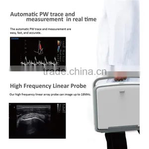 2016 Laptop/Portable 3D 4D Ultrasound Machine Color Doppler Diagnostic System thumbnail-3