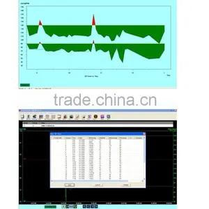 2015 New Color Big LCD Ambulatory Blood Pressure Monitor With Free Analysis Software thumbnail-6