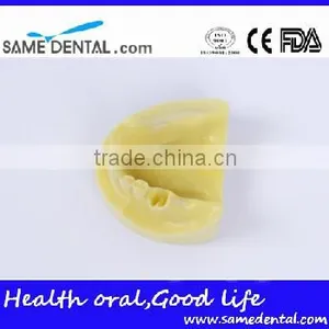 Dental Implant Practice Model (no Gum) Education School Teaching Models thumbnail-3