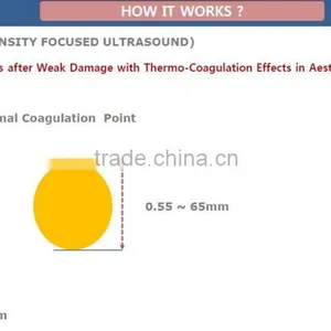 Waist Shaping Portable HIFU Beauty Machine /China HIFU Factory In 5.0-25mm Quality HIFU Technology Deepth 4.5MM Dermis Effective HIFU Results 0.2-3.0J thumbnail-3
