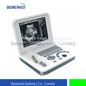 Notebook Type Black and White Ultrasound Scanner Medical Equipment thumbnail-1