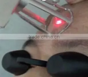 10600nm Laser Skin Resurfacing Medical Beauty Equipment Spot Scar Vascular Treatment Pigment Removal RF Tube Fractional CO2 Laser Ultra Pulse Lips Hair Removal thumbnail-2