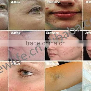 CE Certificated Galvanic BIO Wrinkle Removal Beauty Machine Anti Wrinkle Device for Whitening & Skin Care Facial & Lifting thumbnail-3