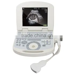 Best Selling Convex , Linear , Micro-convex, Transvaginal, Rectal Laptop Ultrasound & Portable Ultrasound Scanner thumbnail-1