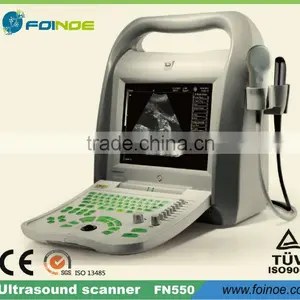 FN550 CE Approved Full Digital B Mode Portable Portable Ultrasound Scanner thumbnail-1