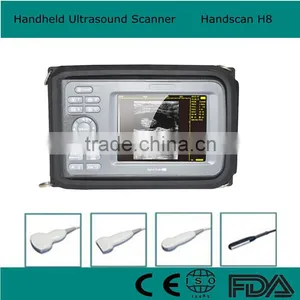 CE*FDA Certified Palm Handheld Ultrasound Scanner Machine With 3.5 Mhz Convex Probe 5.5 Inch Monitor Optional Endo-vaginal thumbnail-1
