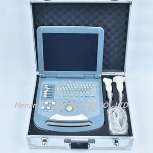 Factory Price Colour Doppler 3D 4D Sonoscape YJ-U200 Portable Scanner Echo Ultrasound thumbnail-4