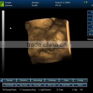 Ultrasound Machine ,ultrasound Machine Price,ultrasound Scanner thumbnail-3