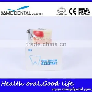 Abscess and Tooth Preparation Model School Teaching Demonstration thumbnail-5