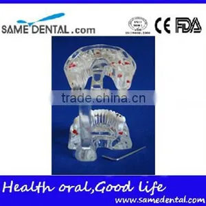 Dental Adult Pathological Dentition Model DEA-48 Teeth Model Teaching Demonstration thumbnail-4