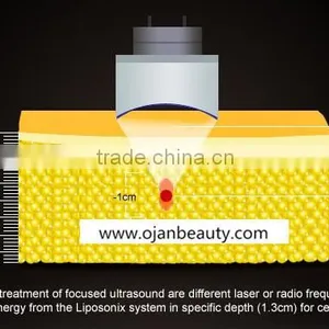 2016 Hottest Slimming Machine Liposunix With 8mm and 13mm thumbnail-6