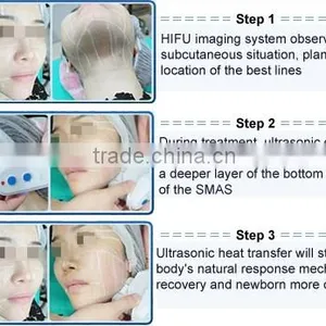 2016 Factory Price China Medical Hifu for Wrinkle Removal/hifu for Skin Tighting thumbnail-5