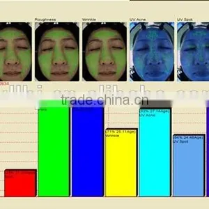 3D Intelligent Skin Analyzer Machine Best Selling Skin Analyzing Equipment thumbnail-6