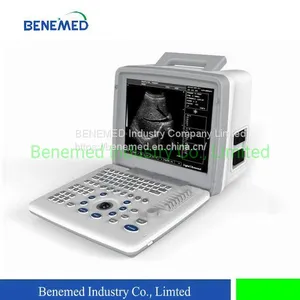 Portable B/W Ultrasound Scanner With Clear Image Quality Hospital Equipment thumbnail-1
