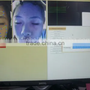 Health Body Digital Analizers the Price of a Dialysis Skin Analyzer Camera for Family Use thumbnail-6