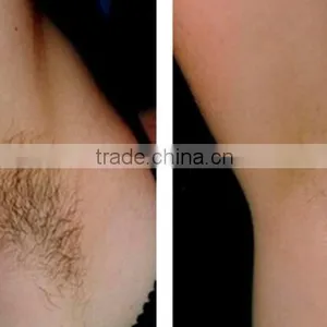 Elight SHR IPL Hair Removal &Skin Rejuveantion Elight Machine&ND Yag Laser thumbnail-6