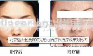 Anti-aging LED PDT Machine Lighting Skin care Pdt Beauty Instrument Laser Led Led Facial Light Therapy Machine thumbnail-5