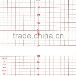 Fetal Monitor Paper / 150mm*100mm-150p Fetal Monitor Recording Paper thumbnail-1