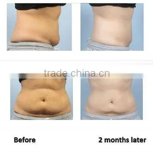 NL-RUV900 6 IN 1home Weight Loss Fat Melting Machine/laser Weight Loss Machine for Home/digital Therapy Weight Loss Machine thumbnail-4
